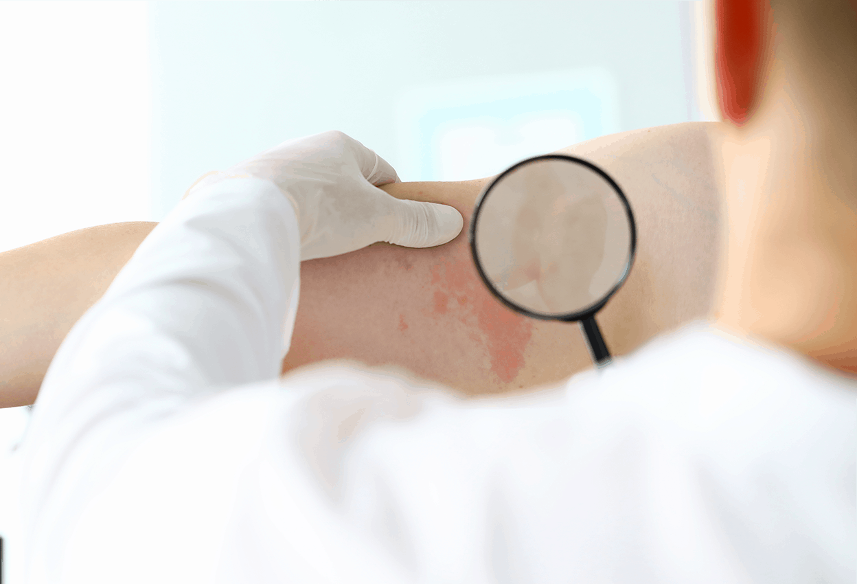 Skin allergy examination performed at the Adult and Children Allergy Asthma Center.